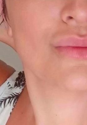 02-DEPOIS_LISI_CARVALHO
